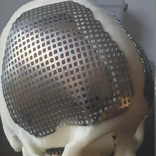 Medical titanium mesh