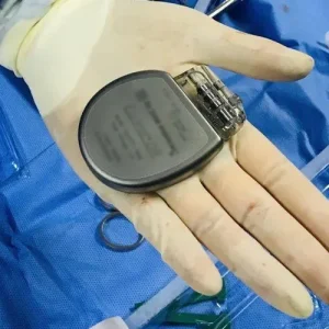 Khung chì y tế đóng một vai trò quan trọng trong các thiết bị y tế bằng cách cung cấp sự hỗ trợ và định vị cần thiết, đảm bảo sự an toàn, ổn định và hiệu quả của các thiết bị cấy ghép. Những khung chì này thường được làm từ vật liệu cấp y tế và trải qua thiết kế và thử nghiệm nghiêm ngặt để đáp ứng các yêu cầu và tiêu chuẩn nghiêm ngặt của ngành y tế.